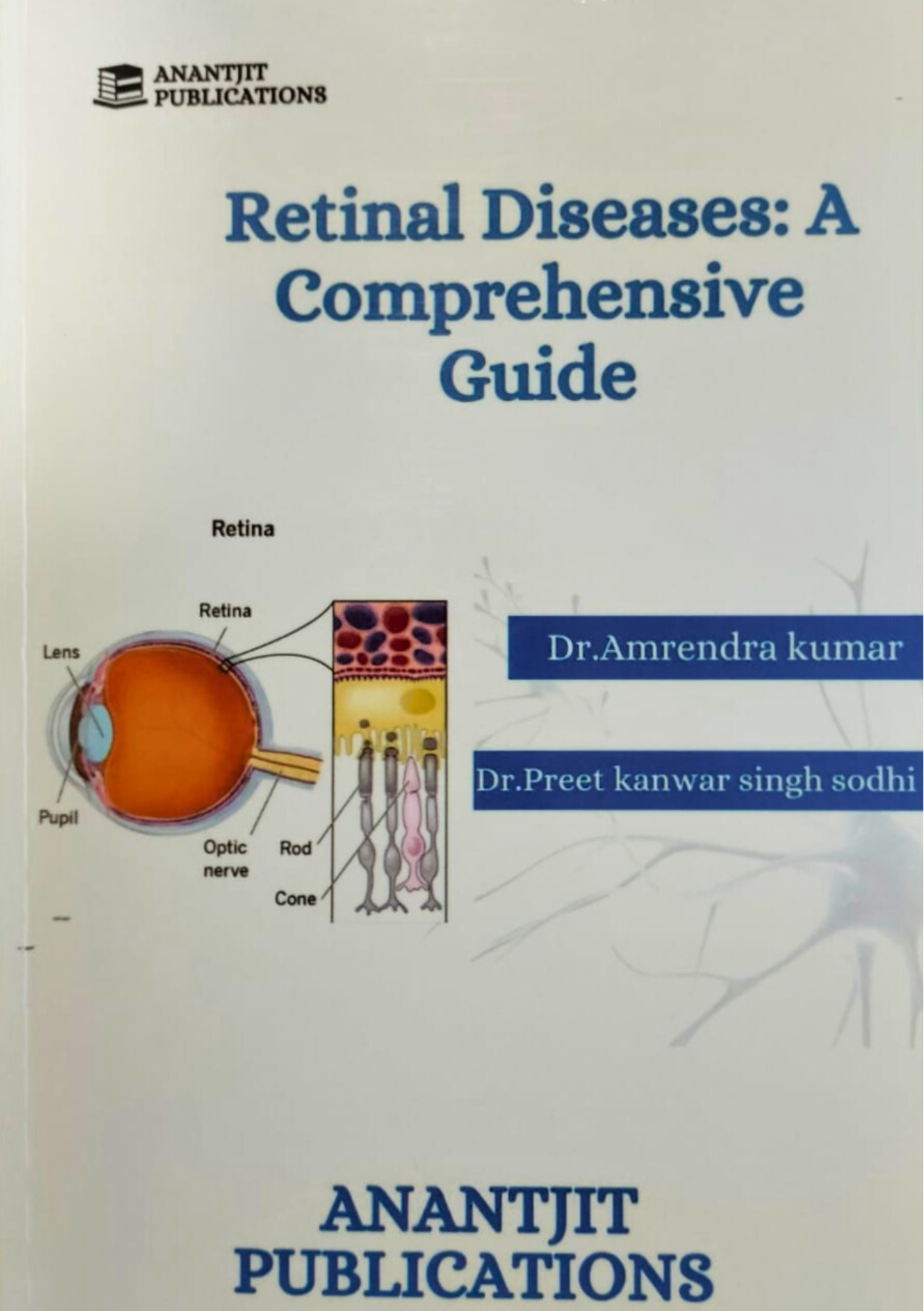 Retinal Disease: A Comprehensive Guide